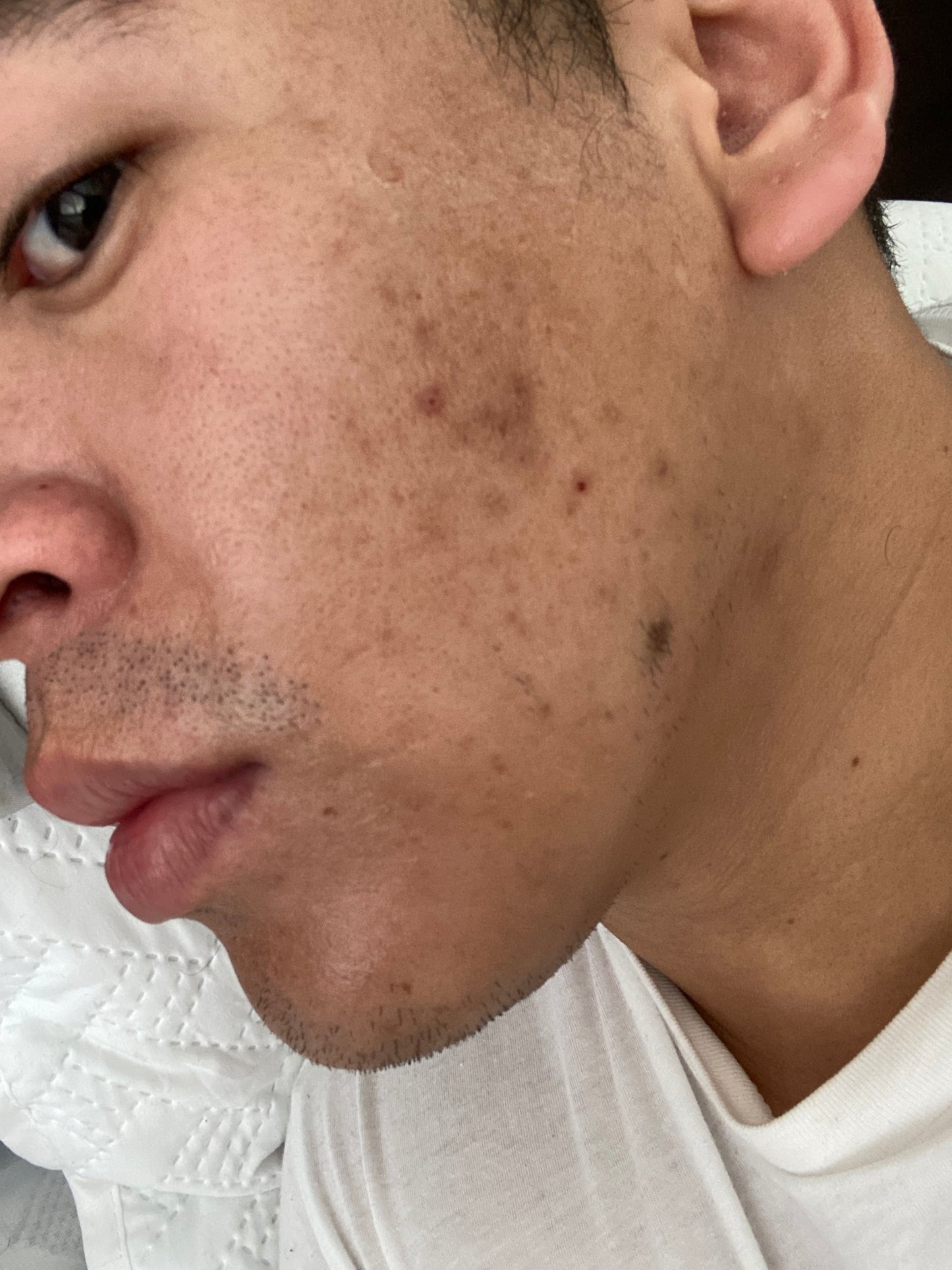 Dúo Serum&Crema